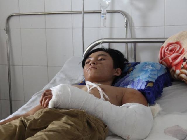 Nối thành công cánh tay bị dập nát dính nhiều hạt lúa - 1 Nạn nhân Nhẩn đang được điều trị tại Bệnh viện Đa khoa Trung ương Cần Thơ