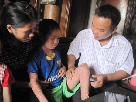  Anh Nguyễn Văn Bền thăm khám bệnh tại nhà cho cháu Kỳ.