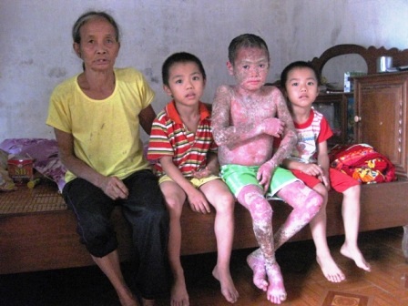  Em Kỳ cùng với 2 người em nhỏ của mình.