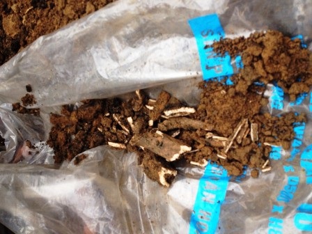 Những mảnh xương đã vỡ được bốc lên.