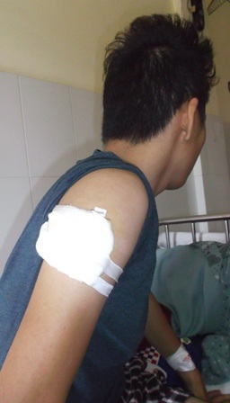 Nạn nhân bị thương đang điều trị tại bệnh viện