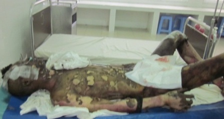 Nạn nhân Tuấn đang được cấp cứu tại bệnh viện