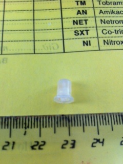 Dị vật được lớn được các bác sĩ lấy ra từ vùng hạ thanh môn của em bé