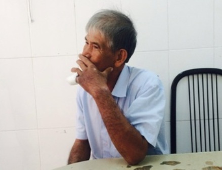 Đang ngủ, bé 27 tháng tuổi bị rắn độc cắn vào miệng - 1 Ông L. bị hoại tử ngón tay do bị rắn lục tấn công
