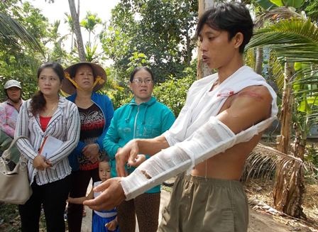 Anh Quốc bị thương ở tay