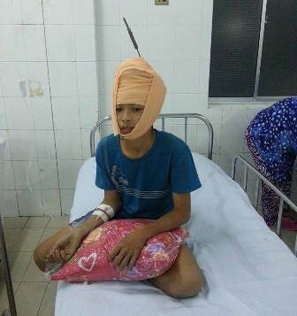 Em Tuấn đang được điều trị ở BV ĐKTƯ Cần Thơ