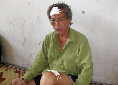 Đừng cứa thêm vào vết thương rừng  - 2