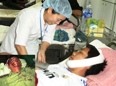 Đừng cứa thêm vào vết thương rừng  - 3