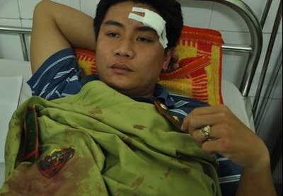 Đừng cứa thêm vào vết thương rừng  - 1