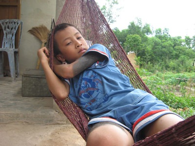 Chuyện kể về cậu bé “người sói” - 1 Chuyện kể về cậu bé “người sói” - 1