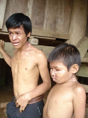 Cùng trăn trở cho số phận những đứa trẻ bị “quỷ ám” - 1