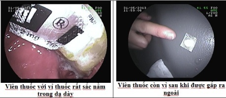 Gắp thành công viên thuốc còn nguyên vỉ - 1 Gắp thành công viên thuốc còn nguyên vỉ