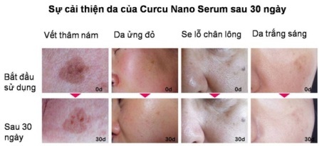 Bí quyết làm trắng da tự nhiên từ Nhật Bản - 3 Bí quyết làm trắng da tự nhiên từ Nhật Bản