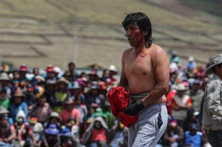  Một người tham gia bị thương nhẹ