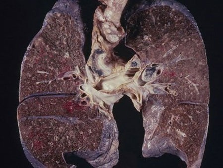 Những quảng cáo “láo” nhất trong lịch sử