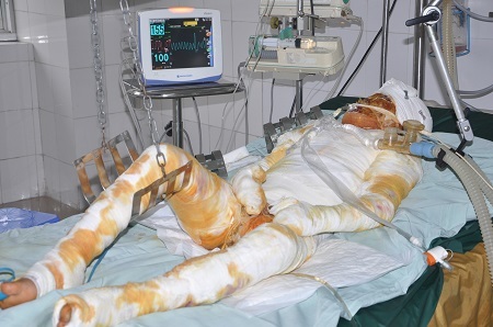 Nhiều kẻ xấu vẫn tiếp tục lừa đảo các hoàn cảnh nhân ái