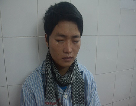  Vẻ mặt đau đớn, tuyệt vọng của A Sèo với những giọt nước mắt đục trắng lăn dài trên má.