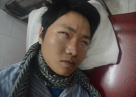 Đôi mắt của em vẫn còn có thể được cứu, nếu được ghép giác mạc kịp thời.