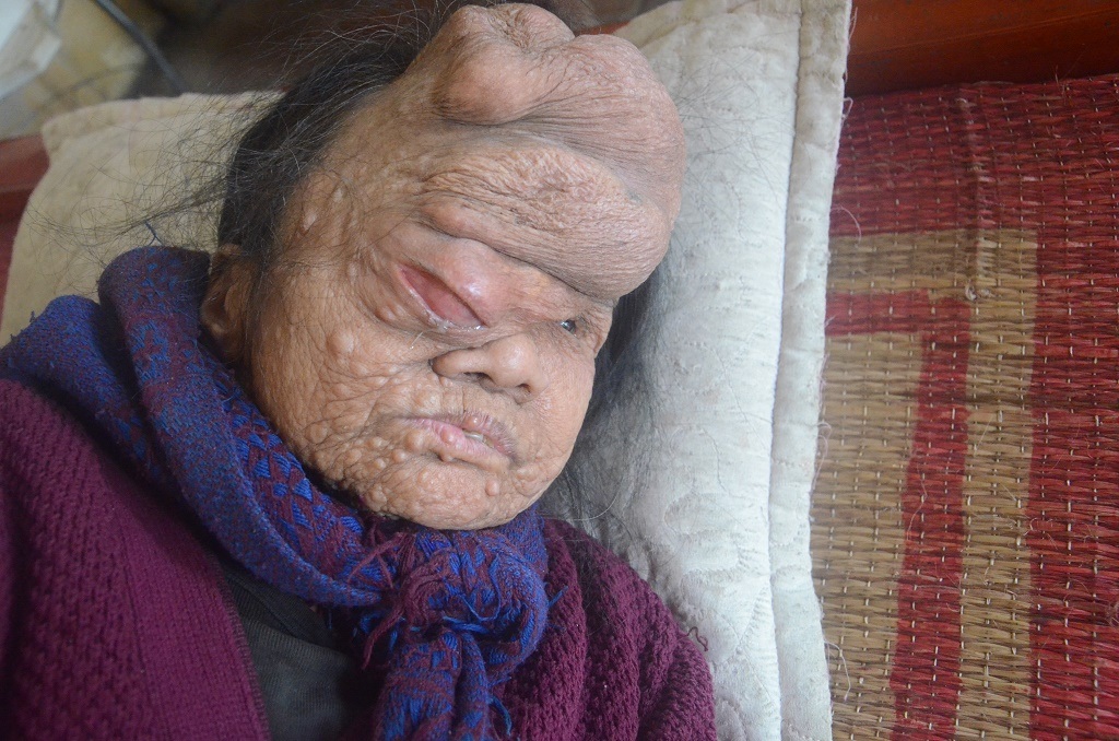 Thức ăn thường ngày của 4 người thường là rau Tầm bóp kiếm được ngoài đồng như thế này.