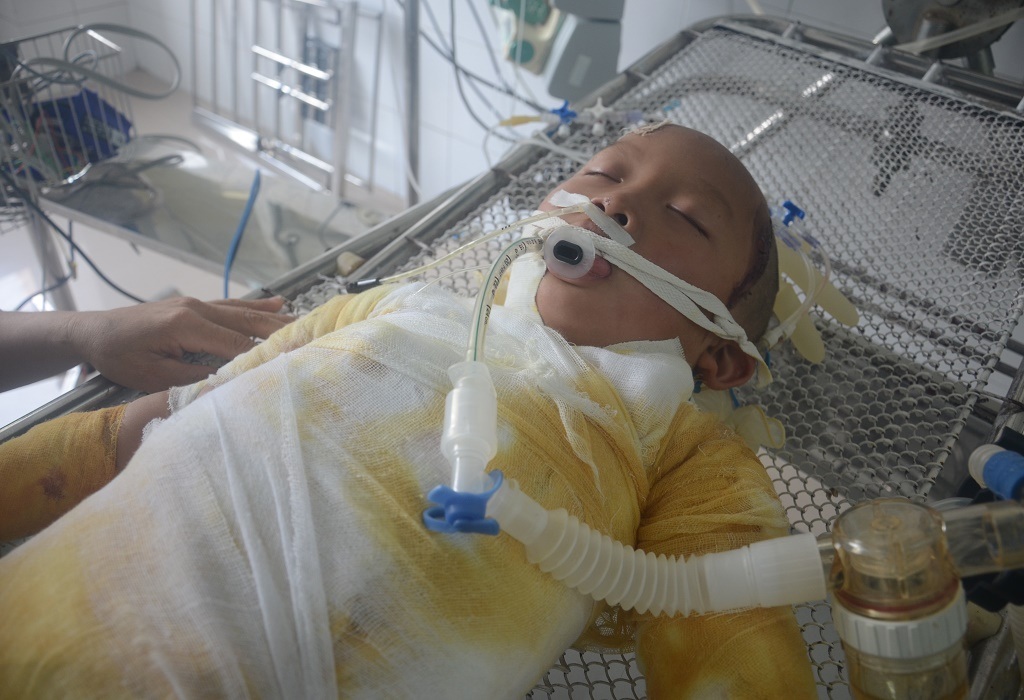 Tính mạng của em hiện chưa có tiên lượng tốt khi em vẫn đang cần đến sự hỗ trợ của máy móc