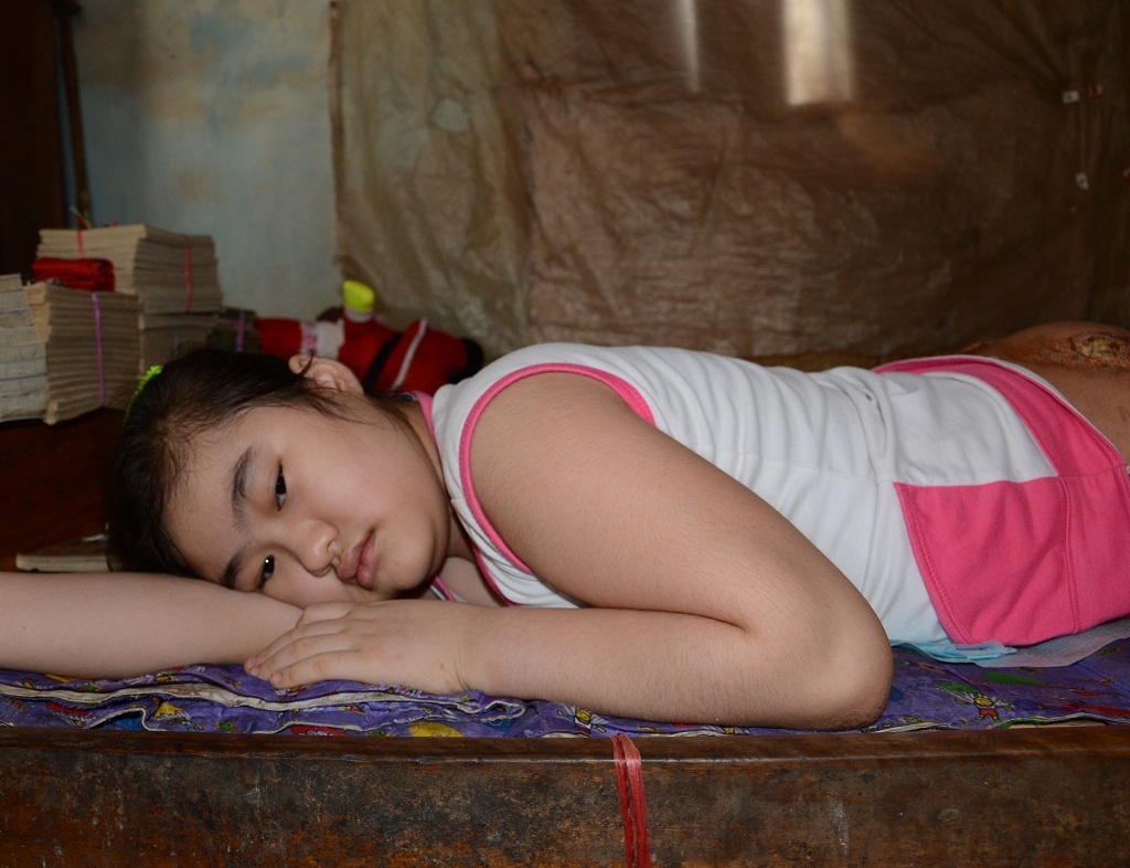 Xót xa bé gái 11 tuổi bại liệt nằm thối thịt