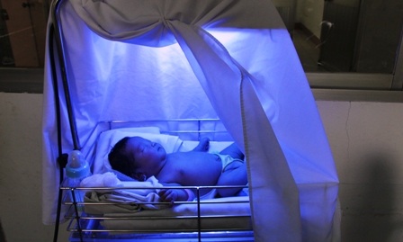 BV quận 2 đang chiếu đèn điều trị bệnh vàng da cho cháu bé.