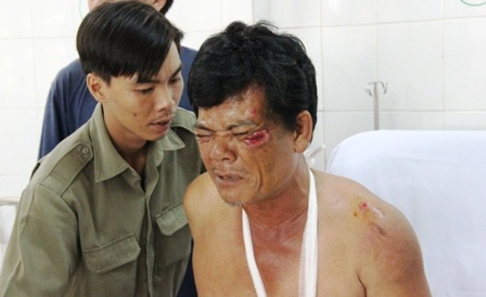 Ông Ra đau đớn với những thương tích trên cơ thể và được các bác sĩ BVĐK Thủ Đức tận tình cứu chữa.