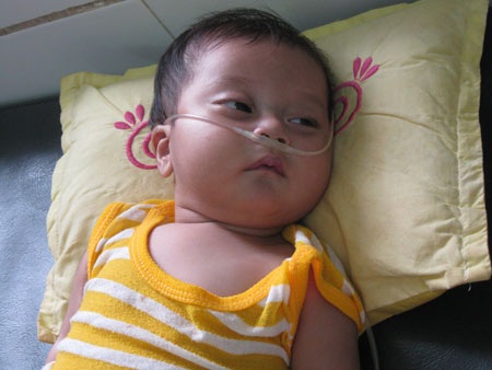 Trái tim bé 7 tháng tuổi có nguy cơ ngừng đập - 1 Trái tim bé 7 tháng tuổi có nguy cơ ngừng đập - 1