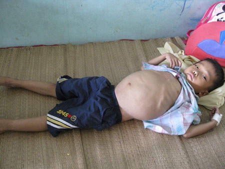 Ánh mắt buồn của cậu bé 8 tuổi mắc bệnh hiểm nghèo  - 1