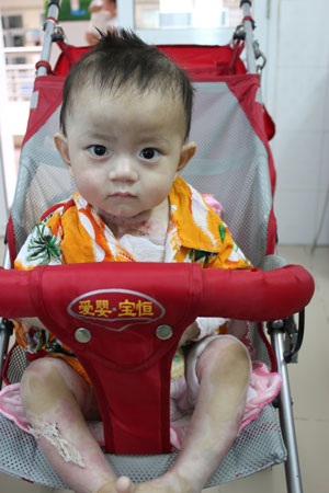 Bé Đức Anh sắp được ra viện - 2