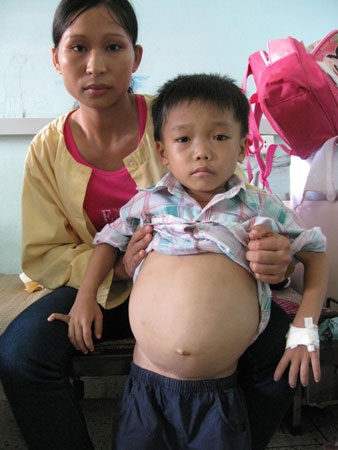 Ánh mắt buồn của cậu bé 8 tuổi mắc bệnh hiểm nghèo  - 2