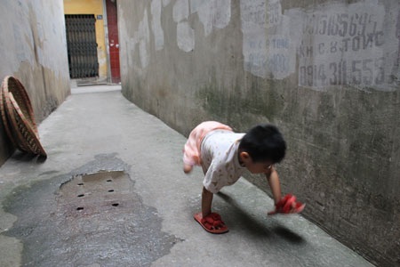 Nụ cười trong trẻo của “cô bé 3 chân” - 4 Nụ cười trong trẻo của “cô bé 3 chân” - 4