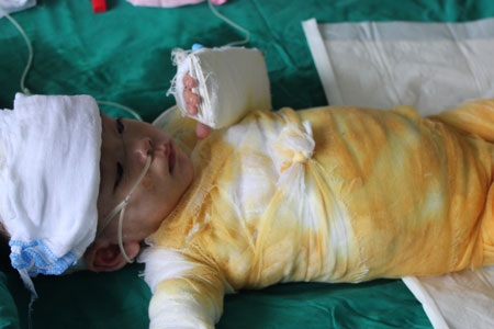 Bé Kiều Trang tạm thời qua cơn nguy kịch - 1 Bé Kiều Trang tạm thời qua cơn nguy kịch - 1