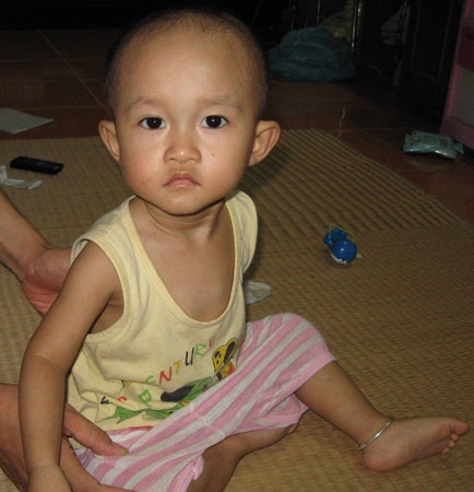 Cô ca sỹ xinh đẹp với đứa con không có hậu môn - 3 Cô ca sỹ xinh đẹp với đứa con không có hậu môn - 3