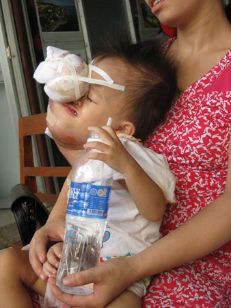 Xin cho con được lấy lại khuôn mặt người - 3 Xin cho con được lấy lại khuôn mặt người - 3