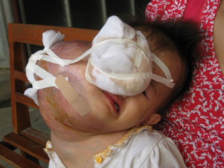 Xin cho con được lấy lại khuôn mặt người - 1 Xin cho con được lấy lại khuôn mặt người - 1