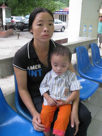 Đôi môi tím tái của bé 2 tuổi vì bệnh tim - 2 Đôi môi tím tái của bé 2 tuổi vì bệnh tim - 2