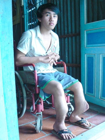 Hai anh em hơn 70 lần... gãy chân - 2 Hai anh em hơn 70 lần... gãy chân - 2