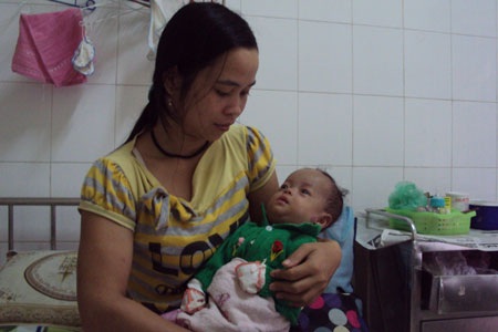Mong manh sự sống của bé sinh non ở tháng thứ 7 - 3 Mong manh sự sống của bé sinh non ở tháng thứ 7