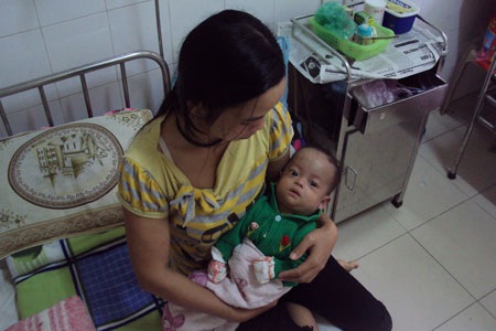Mong manh sự sống của bé sinh non ở tháng thứ 7 - 1 Mong manh sự sống của bé sinh non ở tháng thứ 7