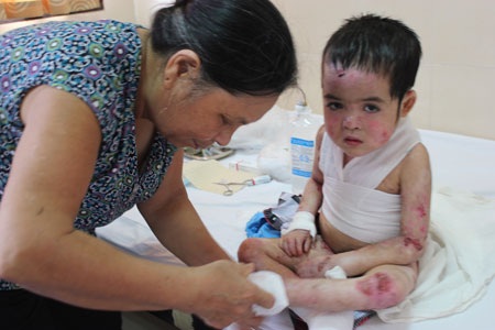 Cậu bé mới 5 tuổi nhưng rất dũng cảm chịu đựng căn bệnh hành hạ hàng ngày