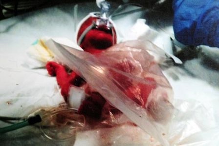 Bé tí hon sống sót nhờ túi đựng bánh Sandwich - 1 Bé tí hon sống sót nhờ túi đựng bánh Sandwich