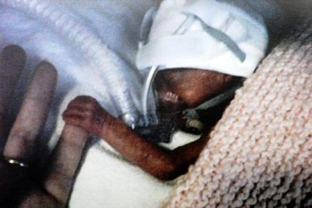 Bé tí hon sống sót nhờ túi đựng bánh Sandwich - 2 Bé tí hon sống sót nhờ túi đựng bánh Sandwich