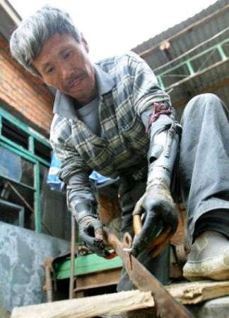 Người đàn ông tự chế tạo đôi tay cho riêng mình - 6 Lê Kiên