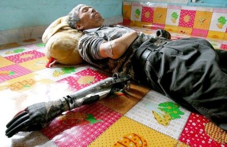 Người đàn ông tự chế tạo đôi tay cho riêng mình - 7 Lê Kiên