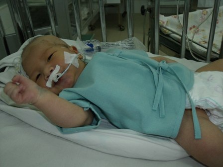 Nhân Hòa sẽ được phẫu thuật tại Nhi Đồng 2 - 1