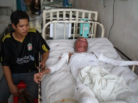 Hạnh phúc mong manh của nạn nhân vụ nổ bình dầu - 1