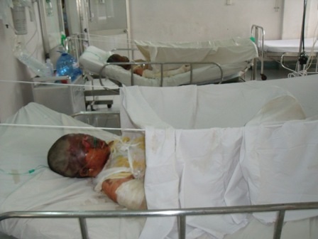 Các nạn nhân vụ nổ bình dầu hơi cầu cứu - 1