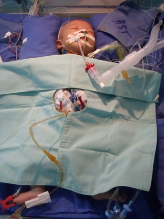 Thăm bé Nhân Hòa sau ca đại phẫu    - 3