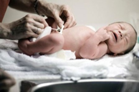 Bị cắt rốn bằng kéo sinh hoạt, cháu bé nguy kịch - 1 Bị cắt rốn bằng kéo sinh hoạt, cháu bé nguy kịch - 1